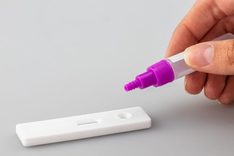 Testes rápidos de antigénio vão continuar a ser comparticipados em setembro